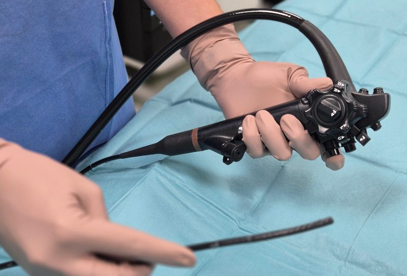Manos de un médico sosteniendo un endoscopio