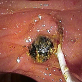 Intervención de CPRE